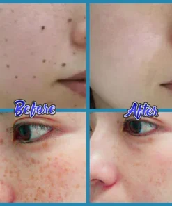 Anti-Blemish Facial Cream