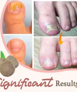 Anti-Fungal Exfoliating Foot Soak