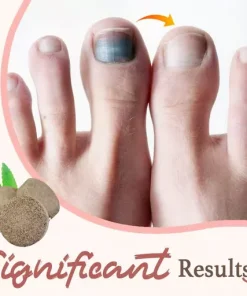 Anti-Fungal Exfoliating Foot Soak