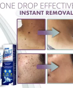 Instant Skin Tag Removal Mousse
