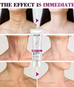 RtopR Mango Neck Firming Rejuvenation Cream