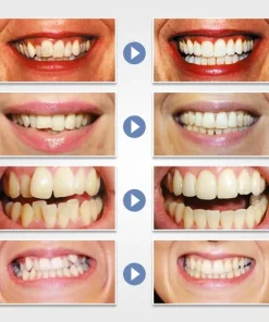 Tooth Orthodontic Braces
