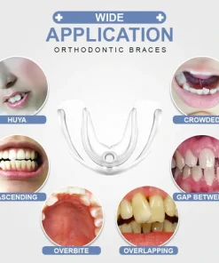 Tooth Orthodontic Braces