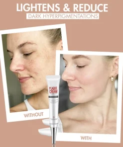 Zero Dark Wizard Whitening Freckle Cream