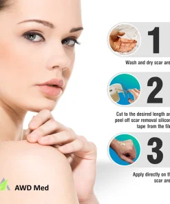 Medical Soft Silicone Gel Tape For Scar Removal