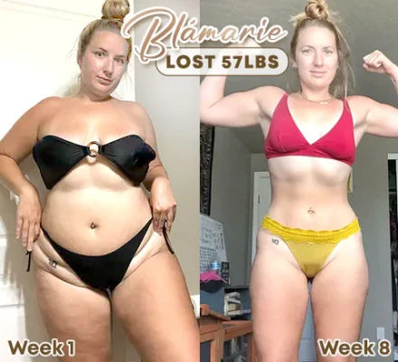 Blámarie SpiniTherao CAMEO Ring 