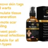 𝐋𝐨𝐭𝐦𝐚𝐲® 𝐁𝐞𝐞 𝐕𝐞𝐧𝐨𝐦 𝐌𝐨𝐥𝐞 & 𝐀𝐠𝐞𝐞 𝐩𝐒𝐩𝐒𝐨𝐦 𝐚𝐢𝐫 𝐒𝐞𝐫𝐮𝐦