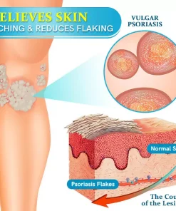 𝗧𝗢𝗗𝗔𝗛𝗢𝗙™ 𝗕𝗲𝗲 𝗩𝗲𝗻𝗼𝗺 𝗠𝘂𝗹𝘁𝗶-𝗦𝘆𝗺𝗽𝘁𝗼𝗺 𝗧𝗿𝗲𝗮𝘁𝗺𝗲𝗻𝘁 𝗖𝗿𝗲𝗮𝗺