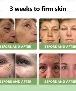 𝐕𝐋𝐒𝐕𝐋𝐒™ 𝐋𝐮𝐱𝐮𝐫𝐢𝐨𝐮𝐬 𝐂𝐨𝐥𝐥𝐚𝐠𝐞𝐧 𝐅𝐢𝐫𝐦𝐢𝐧𝐠 𝐂𝐫𝐞𝐚𝐦