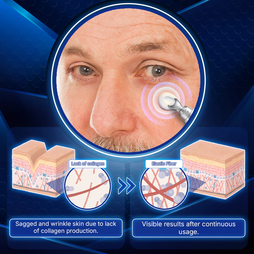 Furzero™ Peptide Ultrasonic Eye Treatment - Image 4