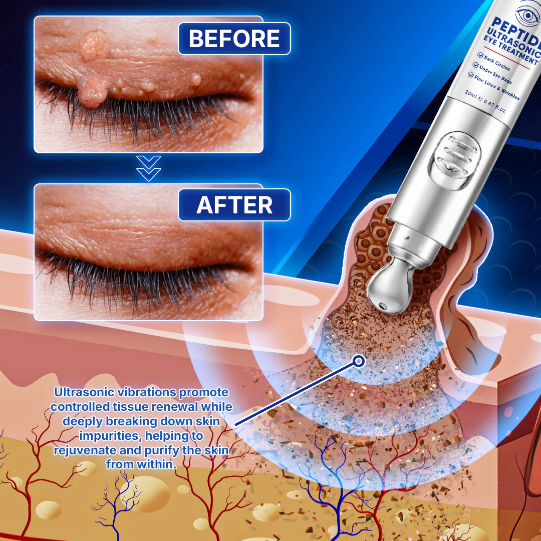 Furzero™ Peptide Ultrasonic Eye Treatment - Image 3