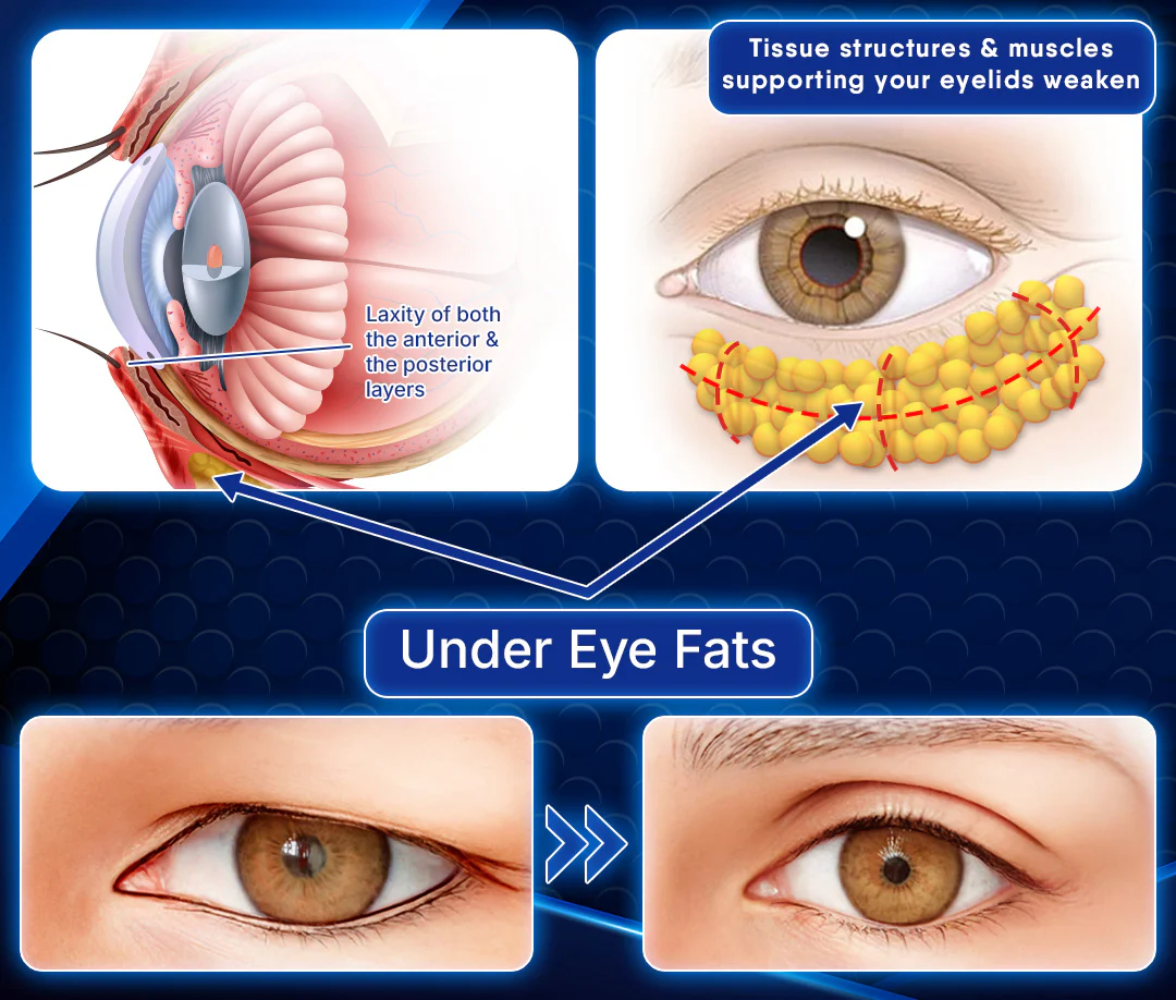 Furzero™ Peptide Ultrasonic Eye Treatment - Image 5