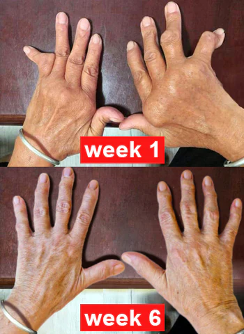 LOVILDS™ Apitoxin Advanced joint and Bone Therapy Cream - Image 2