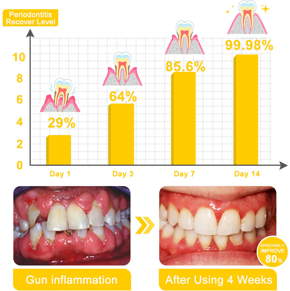 Zoencgz™ Bee Venom Oral Cleansing Treatment Mousse - Image 3
