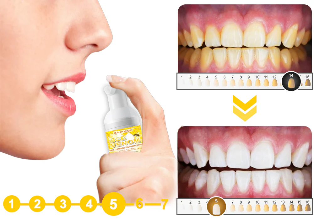 Zoencgz™ Bee Venom Oral Cleansing Treatment Mousse - Image 5