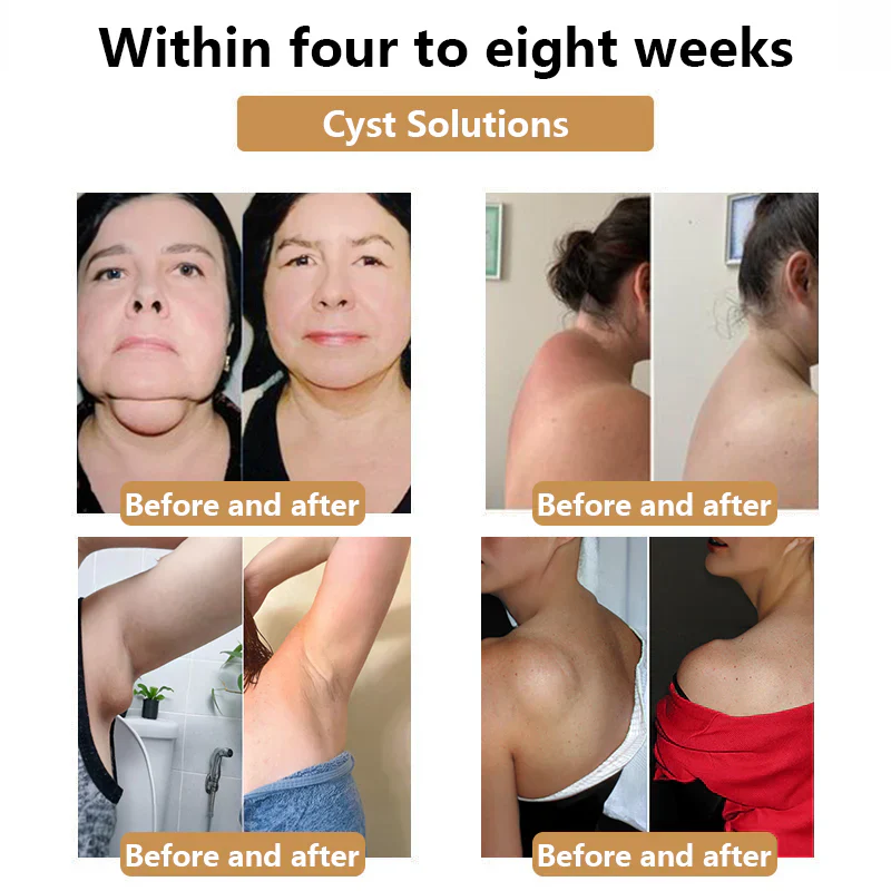 Fivfivgo™ Ultrasonic Fat Burner and Detox Bracelet - Image 2