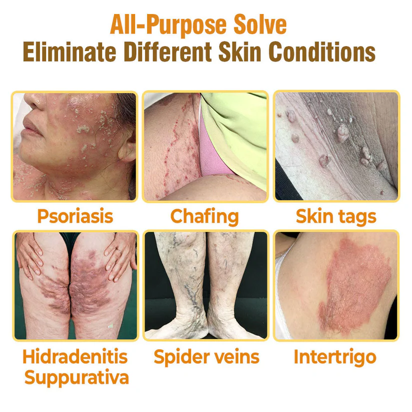 Flysmus™ Bee Venom Comprehensive Cream - Image 2