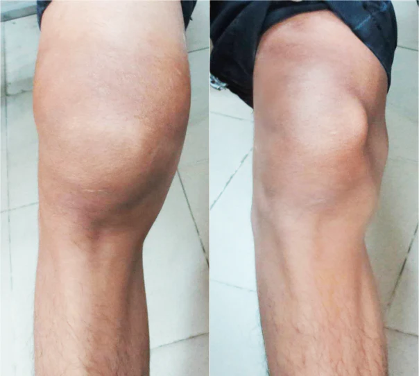 LOVILDS™ Apitoxin Advanced joint and Bone Therapy Cream - Image 4