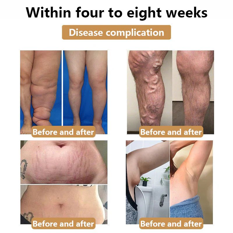 Fivfivgo™ Ultrasonic Fat Burner and Detox Bracelet - Image 3