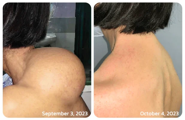 GFOUK™ Maryanni Bee Venom Lymphatic Recovery Cream. Cvreoz™ Maryanni Bee Venom Lymphatic Recovery Cream