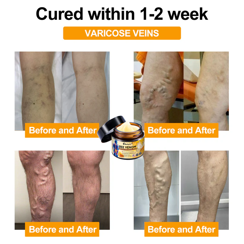 Aetheris™ Bee Venom Arthritis Therapy Cream - ചിത്രം 6