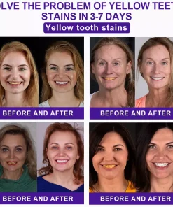 APK APK™ Violet Nano Whitening Ion Gel