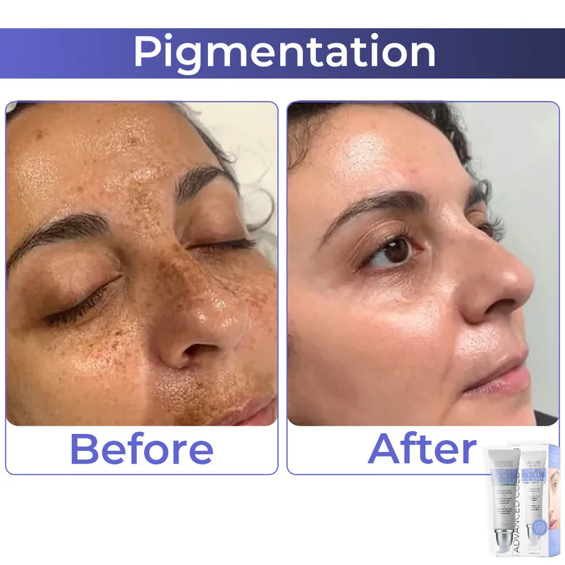 BBOJI™ Advanced Collagen Complete Eye Cream - Image 2