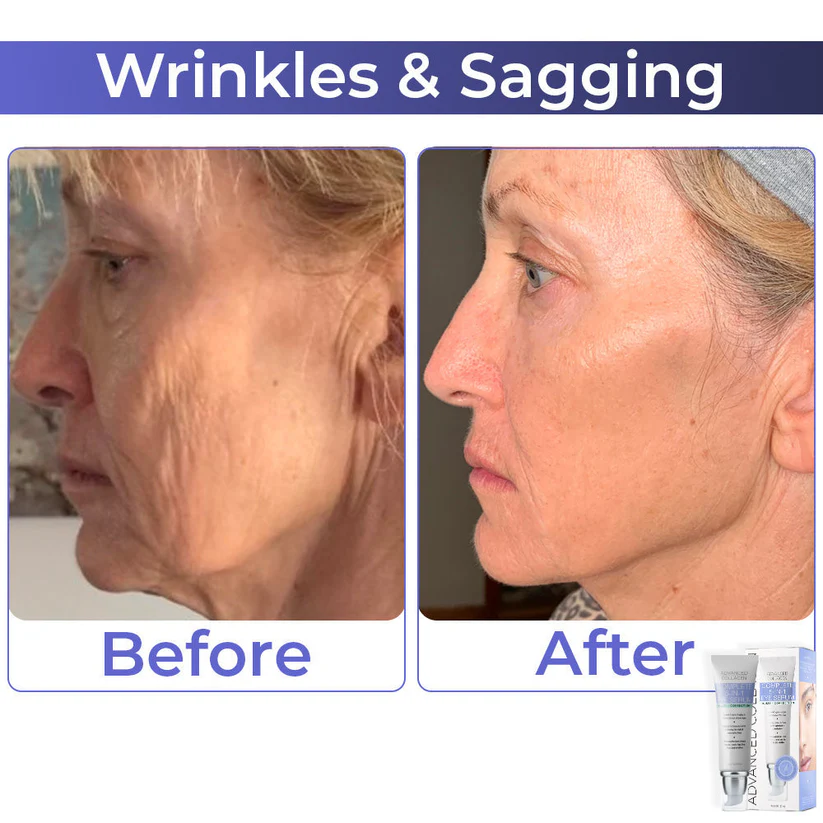 BBOJI™ Advanced Collagen Complete Eye Cream - Image 5
