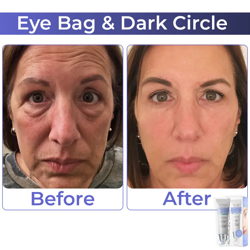 BBOJI™ Advanced Collagen Complete Eye Cream - Image 3