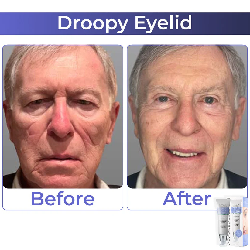 BBOJI™ Advanced Collagen Complete Eye Cream - Image 4