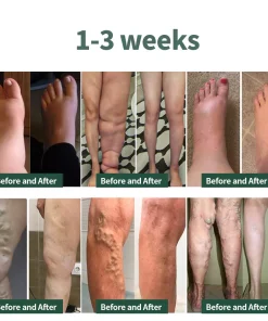 Baicloud Micro-vibration Massage Module Ionic Fiber Repair Socks