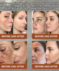 Bostore™ Echinacea & Psoralea corylifolia serum