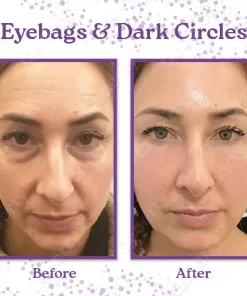 Ceoerty™ GlowEyes Collagen Eye Cream