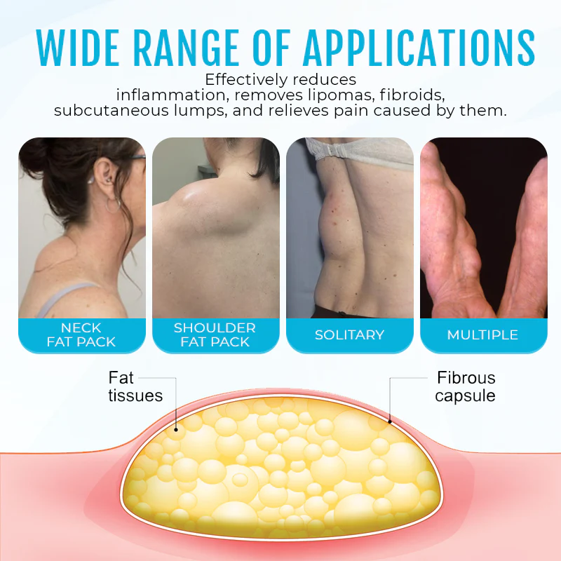 Biancat™ LumpClear Lipoma Relief Cream - Imaj 4