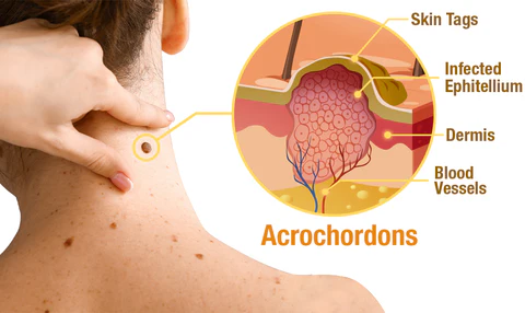 LOVILDS™ Clear Skins Bee Venom Treatment Spray - Image 5