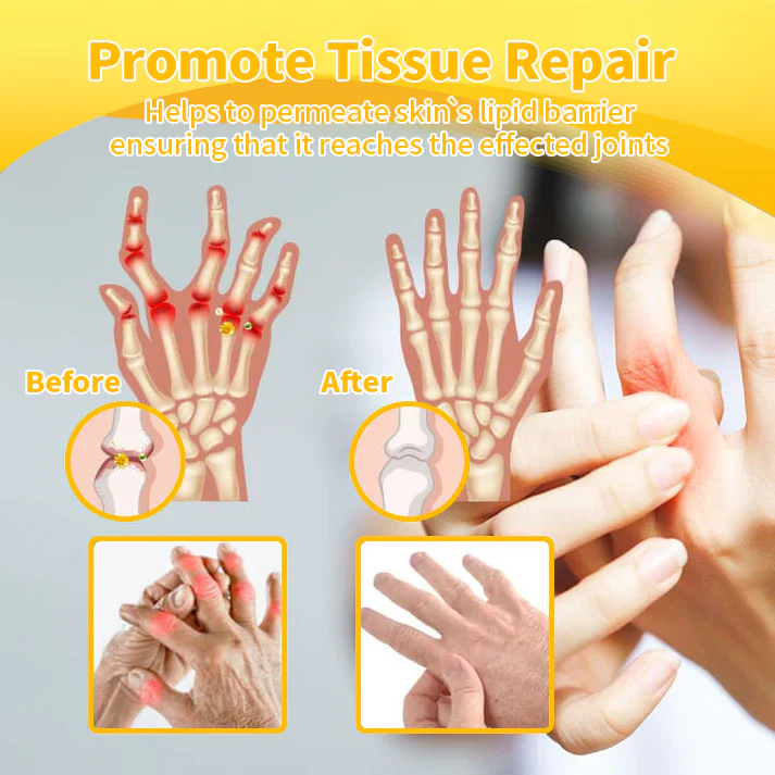 LOVILDS™ Apitoxin Advanced joint and Bone Therapy Cream - Image 3