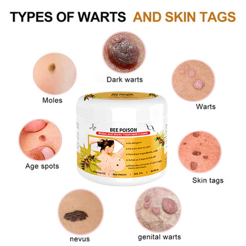 QIAWI™ BEE POSON MOLE AND WART TREATMENT CREAM