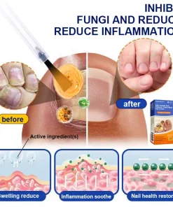 Raindew™ Bee Venom Nail Fungus Treatment Solution