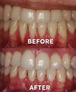 TGA Approved | Ourlyard™ Coconut oil mouthwash essential oil