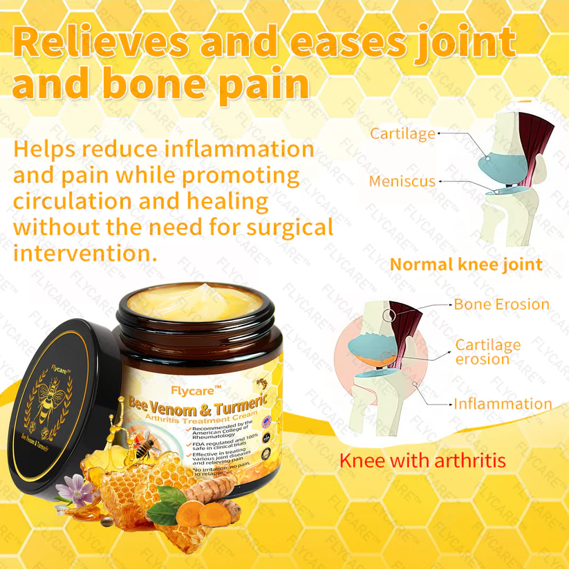 FLYCARE™ Bee Venom & Turmeric Arthritis Treatment Cream - Image 2