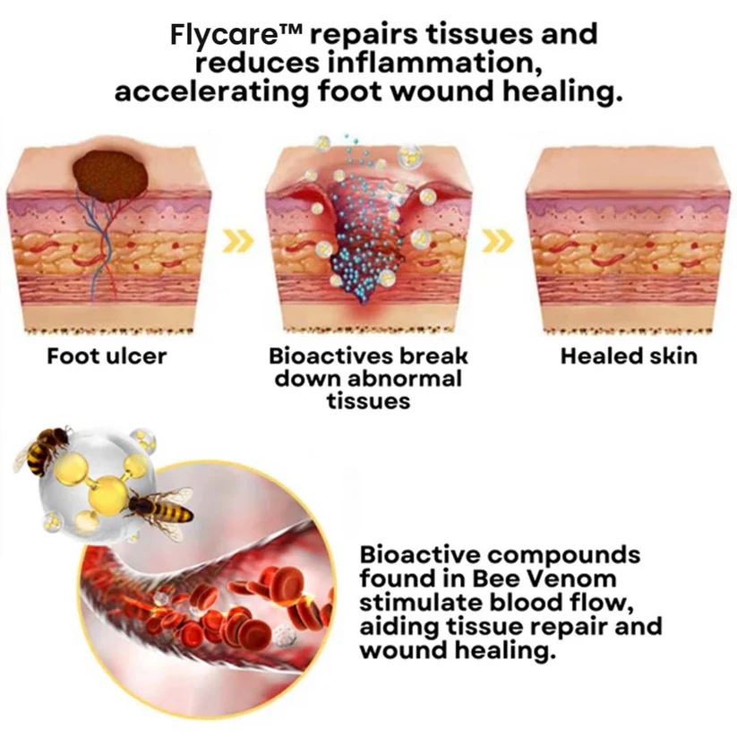 FLYCARE™ BeeVenom espre pou tretman pye dyabetik - Imaj 2