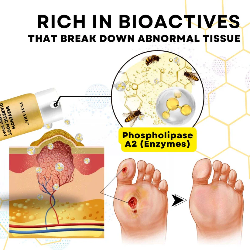 FLYCARE™ BeeVenom espre pou tretman pye dyabetik - Imaj 4