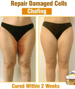 flysmus™ Bee Venom Comprehensive Skin Treatment Cream