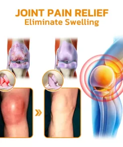 flysmus™ Bee-Venom Pain-Relief Bone Healing Cream