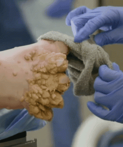 flysmus™ Powerful All-BodySkin Treatment cream