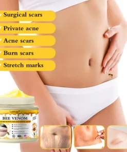 𝙇𝙤𝙩𝙢𝙖𝙮™ 𝑩𝒆𝒆 𝑽𝒆𝒏𝒐𝒎 𝑺𝒄𝒂𝒓 𝑹𝒆𝒎𝒐𝒗𝒂𝒍 𝒂𝒏𝒅 𝑰𝒏𝒕𝒊𝒎𝒂𝒕𝒆 𝑨𝒓𝒆𝒂 𝑨𝒄𝒏𝒆 𝑹𝒆𝒎𝒐𝒗𝒂𝒍 𝑪𝒓𝒆𝒂𝒎