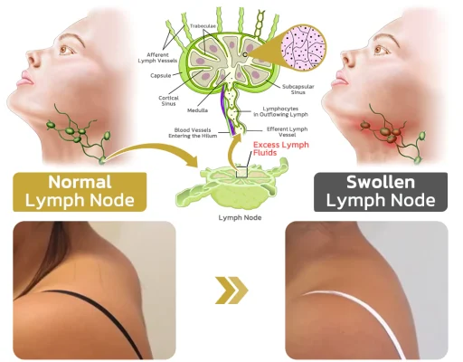 Ceoerty™ Lympho Boost Germanium Earrings