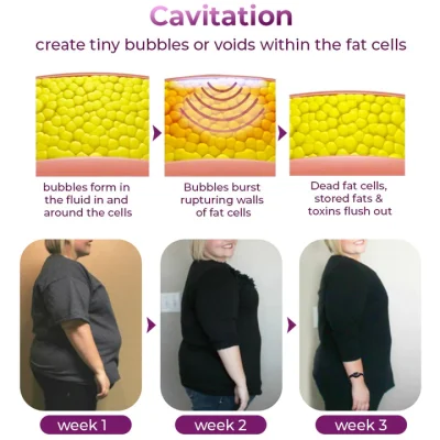 GFOUK™ Ultrasonic Fat Blasting and Detoxing Wristband. Demoio™ Ultrasonic Fat Blasting and Detoxing Wristband