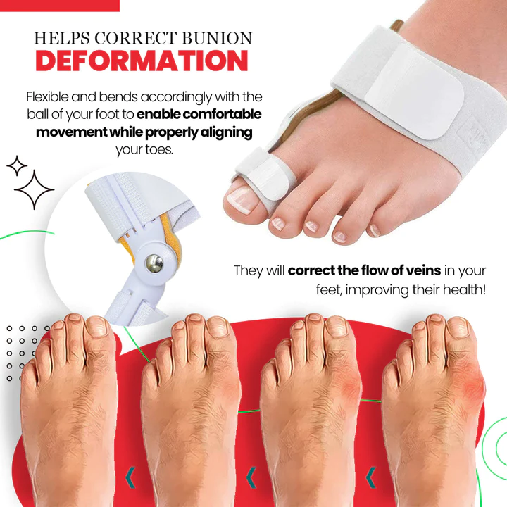 ToeAlign™ Bunion Cream & Corrector Set - Image 4