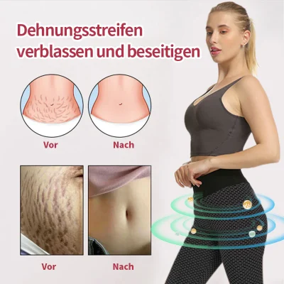 Anyidea™ Ionic Shapewear